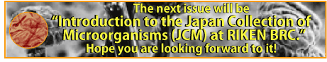 JCM