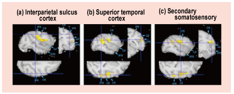 Fig.2