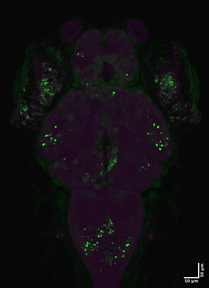 nig-zebra/MAX_hCF261AOR_C_HuCmC_d5_1309.oib_-_Series_1.png