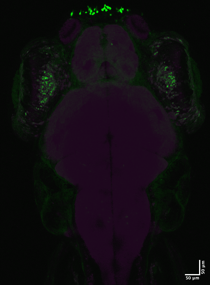 nig-zebra/stack71_MAX_hcf255AORC_HuCmC_d5_1152.oib_-_Series_1.png