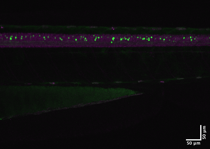 nig-zebra/stacks89_MAX_hcF259AORC_HuCmC_d3_1416.oib_-_Series_1.png
